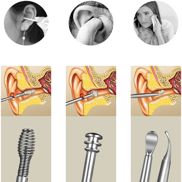 Set za čišćenje ušiju 03